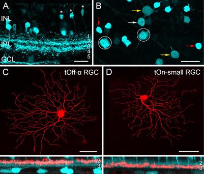 Spike desensitisation as a mechanism for high-contrast selectivity in retinal ganglion cells